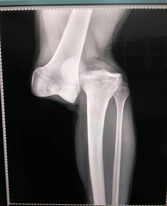 1691309442654018314.jpeg v体育-对手膝盖被踩脱臼得休1年 马塞洛为何还赢得尊重?